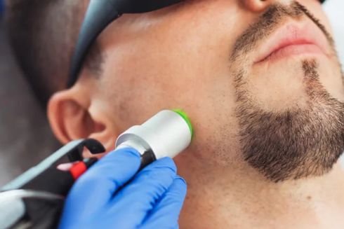 Лазерна епіляція обличчя у чоловіків: переваги та особливості