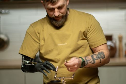 Український стартап зі створення протезів отримав $5 млн інвестицій: гроші підуть на унікальну розробку