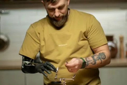 Український стартап зі створення протезів отримав $5 млн інвестицій: гроші підуть на унікальну розробку