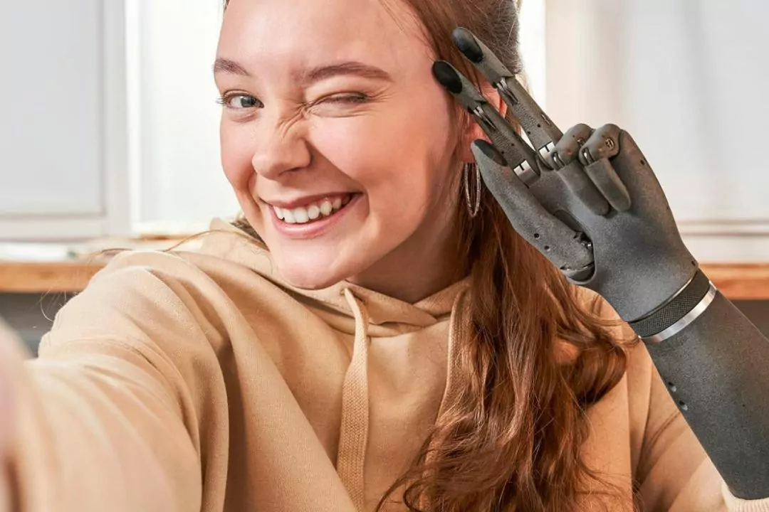 Як українська компанія Esper Bionics створює сучасні біонічні протези руки для військових і цивільних