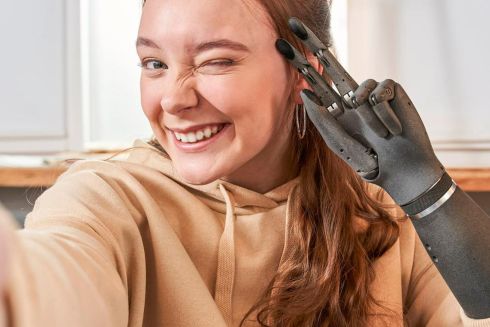 Як українська компанія Esper Bionics створює сучасні біонічні протези руки для військових і цивільних