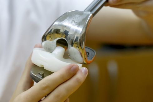 У КПІ почали розробляти колінний протез для поранених військових