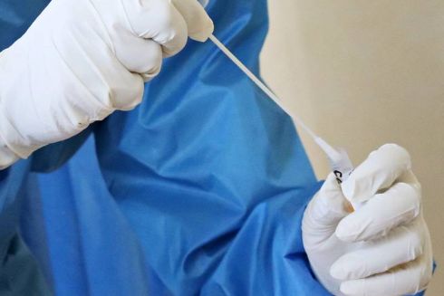 Частные лаборатории будут делать тесты на COVID-19 за счет государства