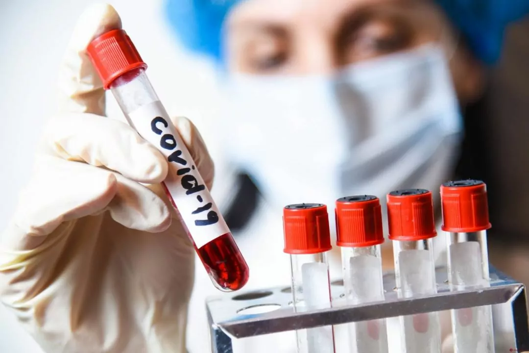 Персонал магазинов и ресторанов в Киеве будут тестировать на антитела к COVID-19