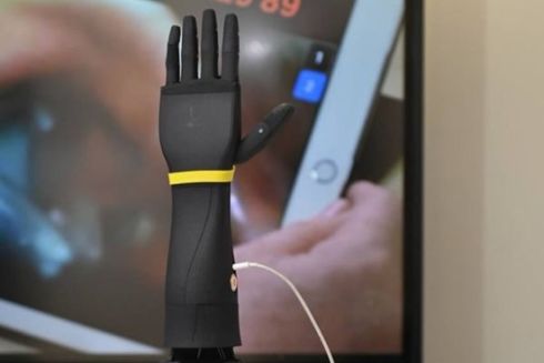 GlobalLogic представила бионические протезы и дефибрилляторы, созданные в Украине